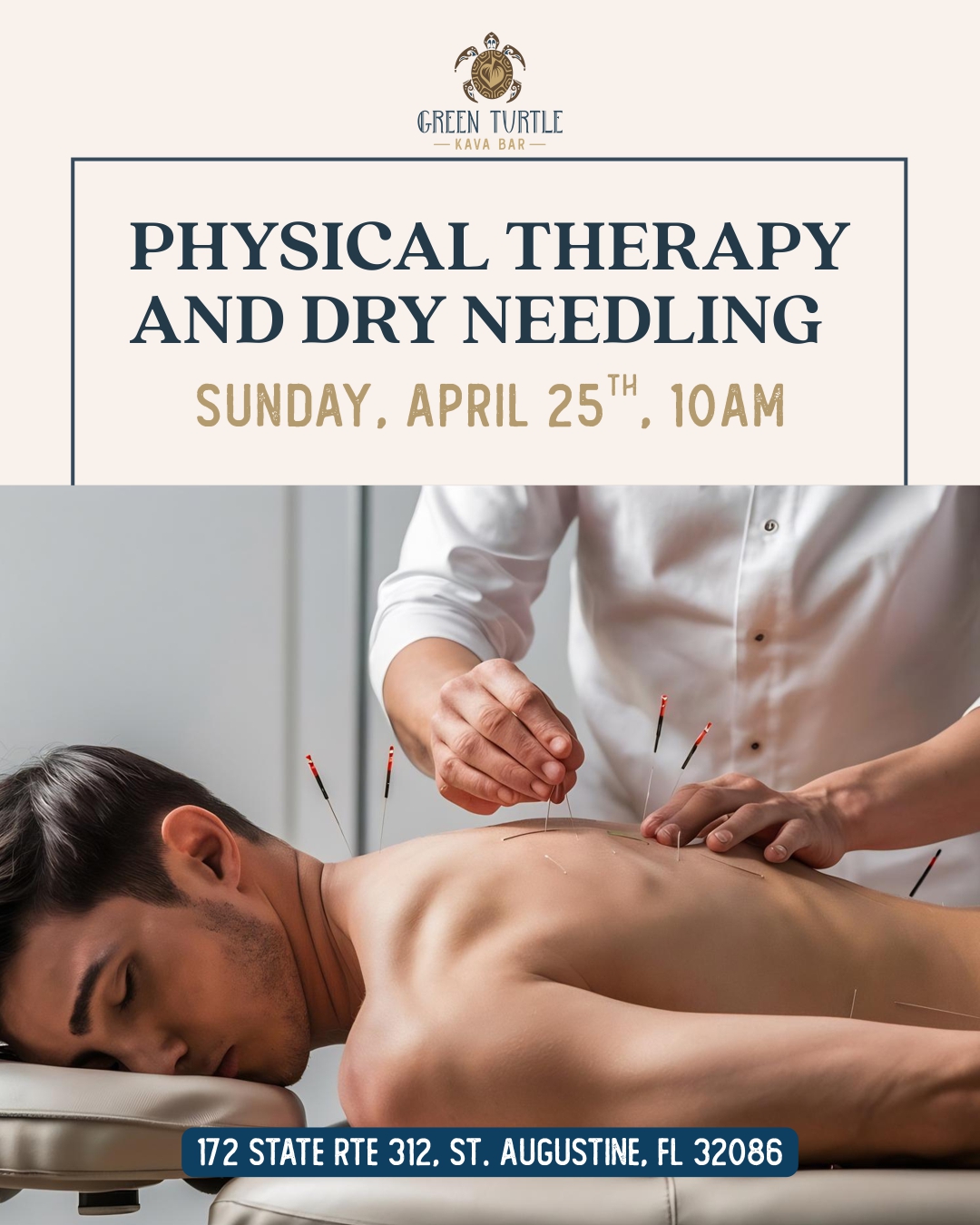 Physical Therapy and Dry Needling